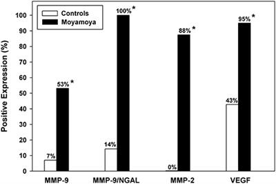 Non-invasive Urinary Biomarkers in Moyamoya Disease